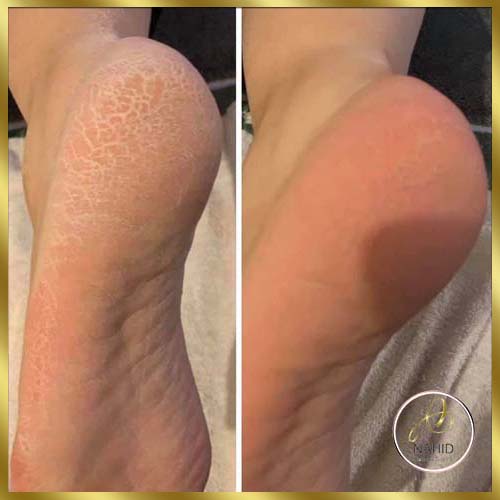 گالری پدیکور